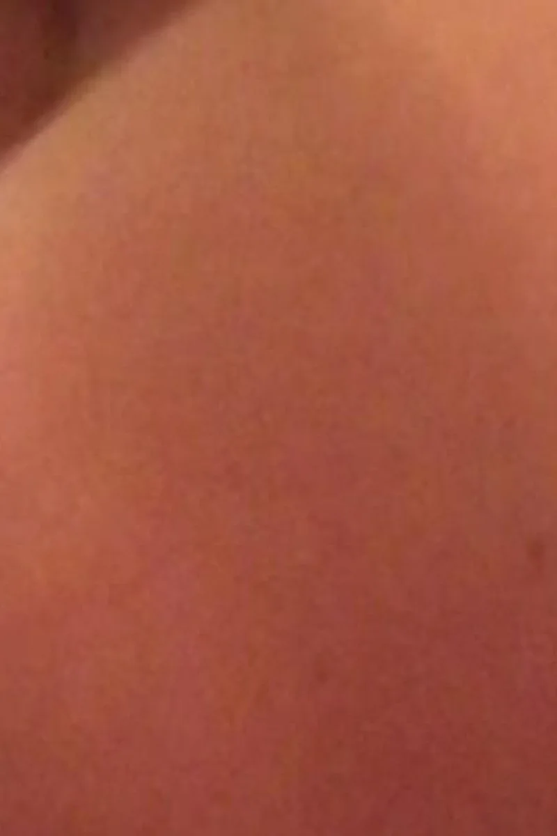 Tease You