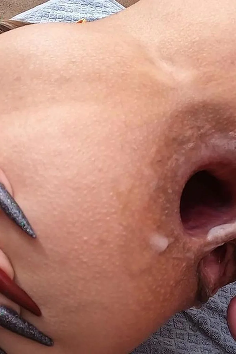 POV Outdoor Anal - Gapes, Loud Farts & Dripping Cum Fart Creampie