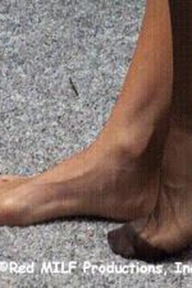 Fetish173 Foot Fantasies, Bunion Feet 5