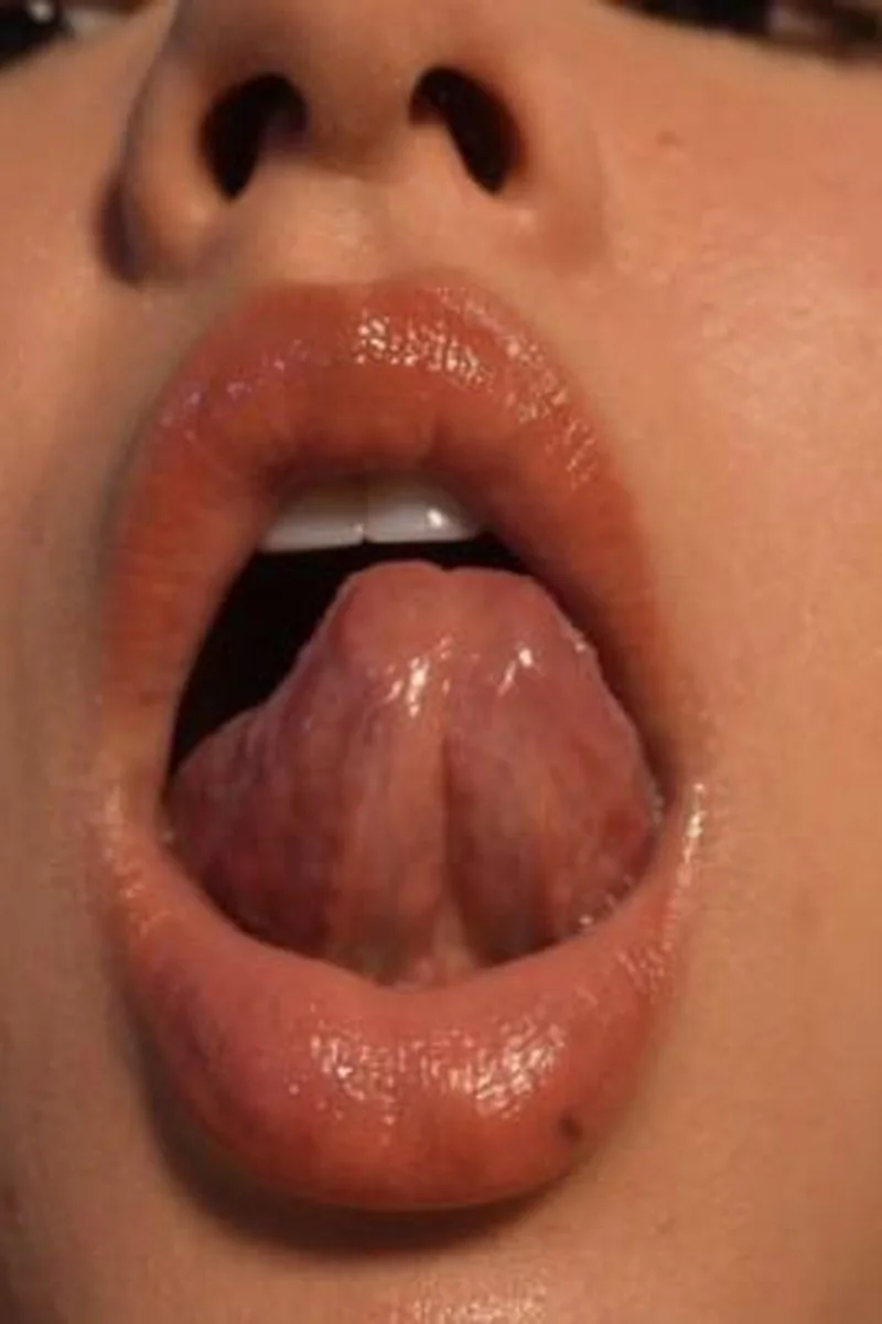 My Tongue And My Lips - The Oral Fix You Need