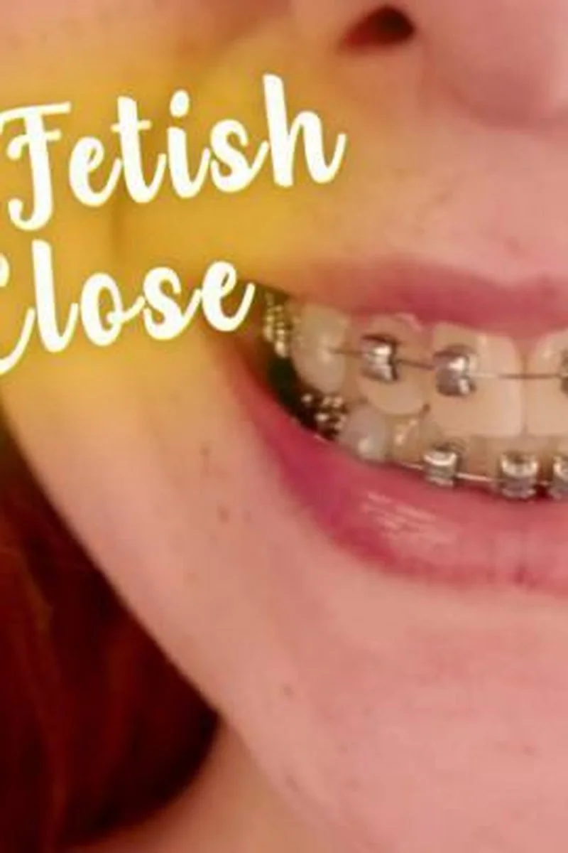 Braces Fetish Up Close