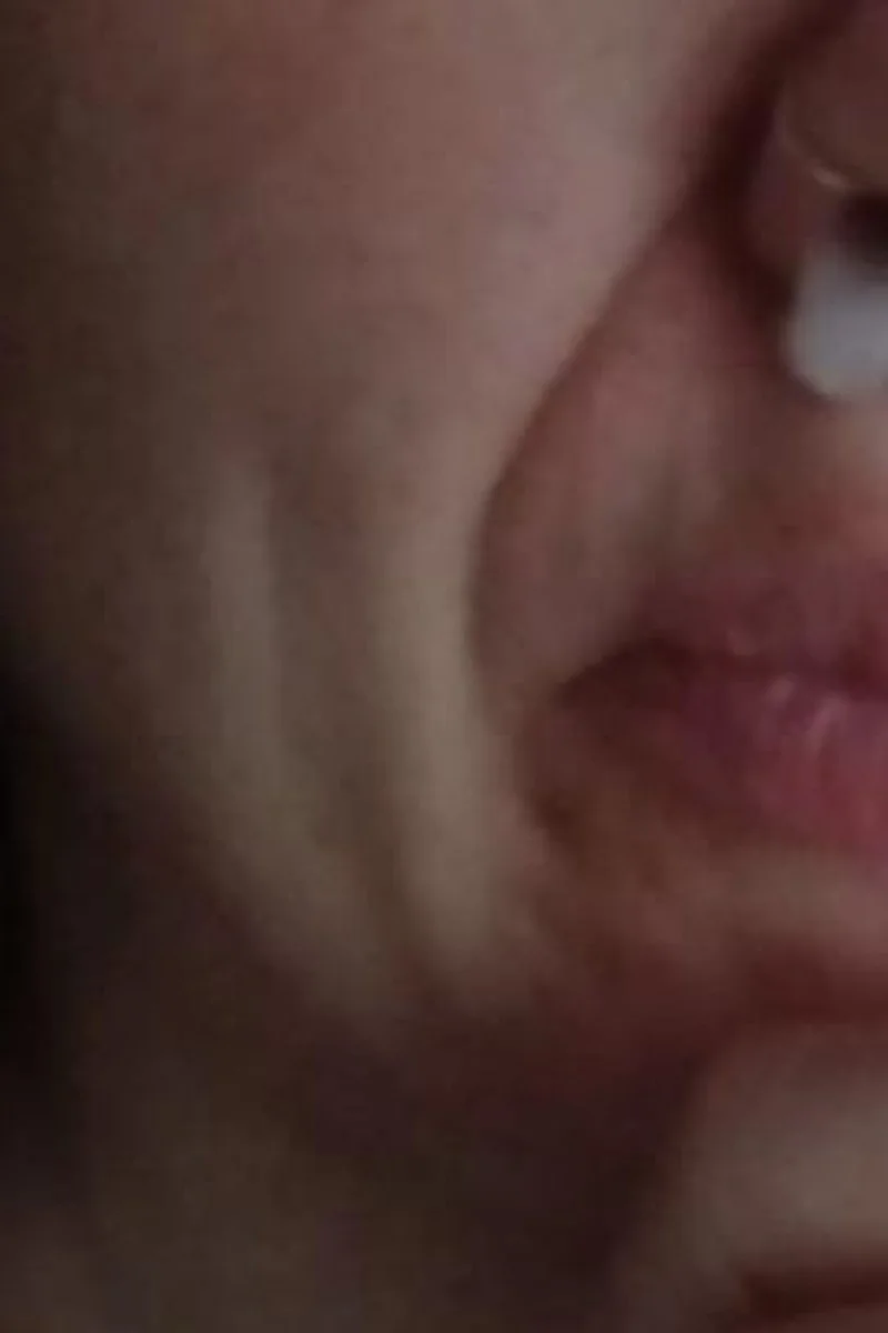 Loud Chesty Bronchitis Cough & Nose Blowing Real Coughing