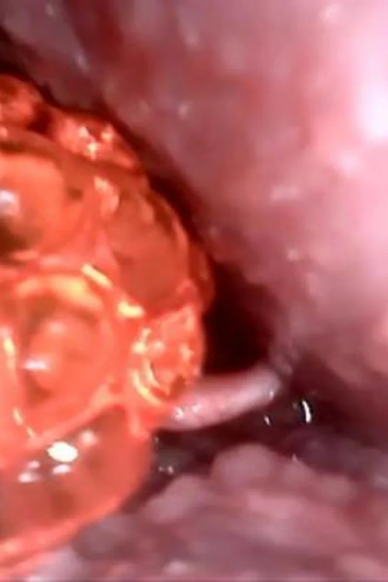 Alien Gummy Traveler Sucked Down William's Throat