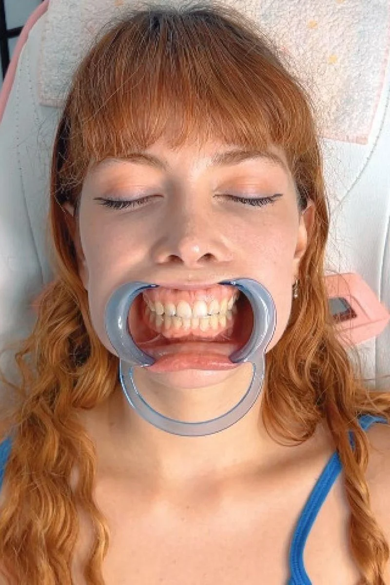 Closeup Mouth Exam