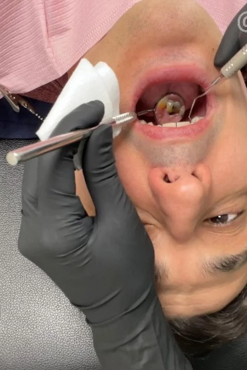 Nurse Bunny Checks Dr. Canada's Teeth Multi Angle