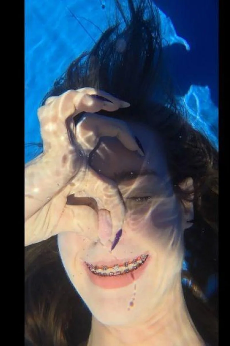 Braces Underwater Showing Off My Metal Braces Powerchain